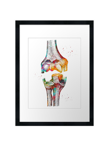 Elbow framed wall art poster - elbow,