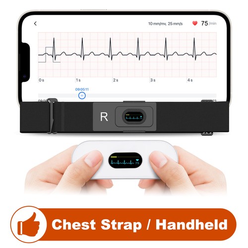 Checkme er2 mobile ecg - checkme, er2-s