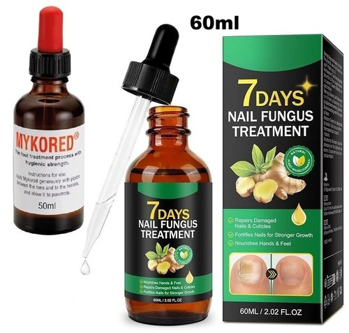 Fungal nail treatment - fungal,