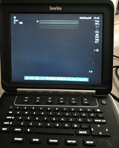 Sonosite edge ultrasound - edge,
