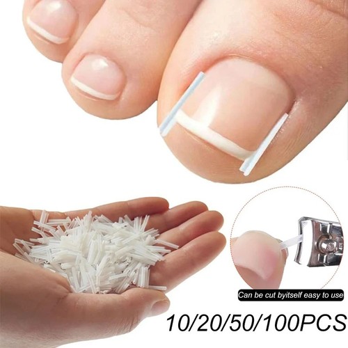 50pcs ingrown toenail - 50pcs,