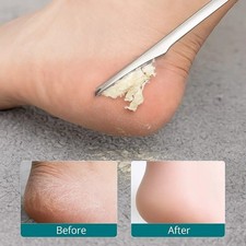 1/5/3Pcs Stainless Steel Nail
