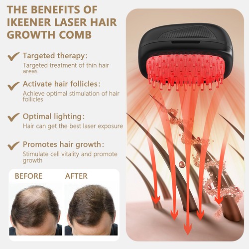 Red light hair loss - light,