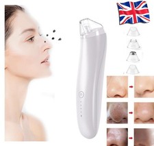 Luxury Confidence Keratin Blackhead Remover Electric Face Suction Pore Vacuum