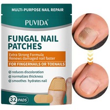 320x Anti Fungal Nail Treatment Patches Toe Fungus Onychomycosis Repair Sticker