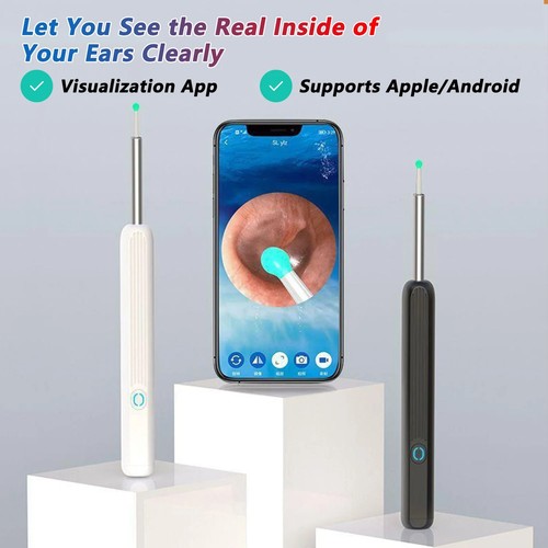 Smart ear cleaner - smart, otoscope