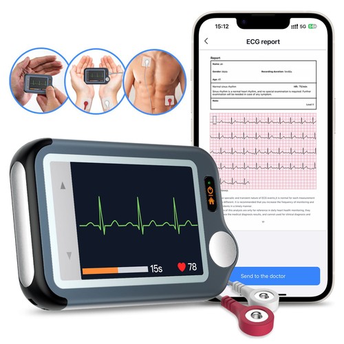Mobile ecg ekg heart monitor - mobile,