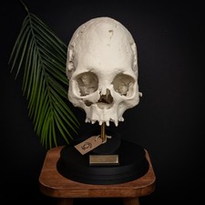 Peruvian Elongated Human Skull