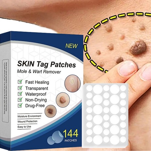Skin tag remover - skin,