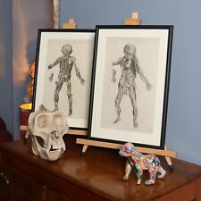 Antique biological illustrations- Vintage drawing- framed oddity taxidermy human
