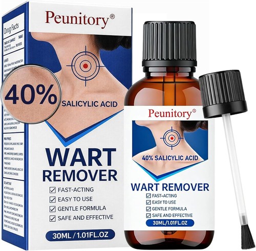 Wart remover liquid gentle - remover,