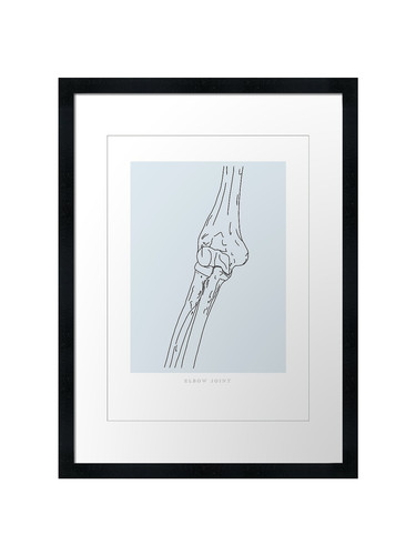 Elbow joint line - elbow, wall