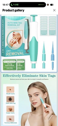 Skin removal kit - skin,