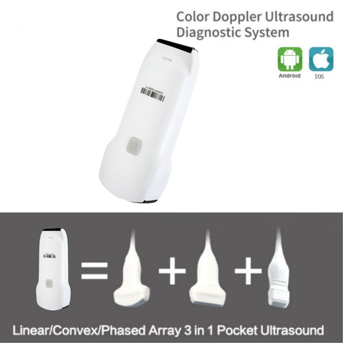 Wireless ultrasound - wireless,