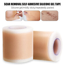 Scar Removal Silicone Gel Tape