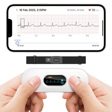 2025 New ER2-S Mobile ECG EKG Heart Monitor - Smartphone Compatible AI Analysis