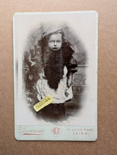 RARE UNUSUAL OLD CABINET PHOTO GIRL PROSTHETIC LIMB DISABILITY LEIGH BX 15