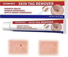 STRONG SKIN TAG REMOVER Cream