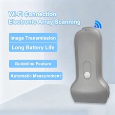 Wireless Ultrasound Probe