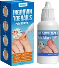 Ingrown Toenail