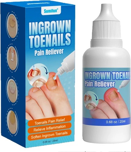 Ingrown toenail - ingrown,