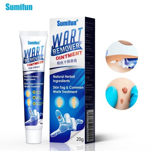 Wart removal treatment - wart,