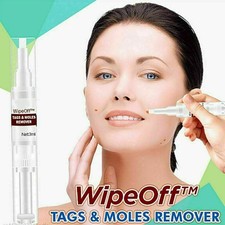 Skin Tag Removal Warts Remover