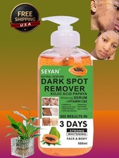 Kojic Papaya Skin Whitening