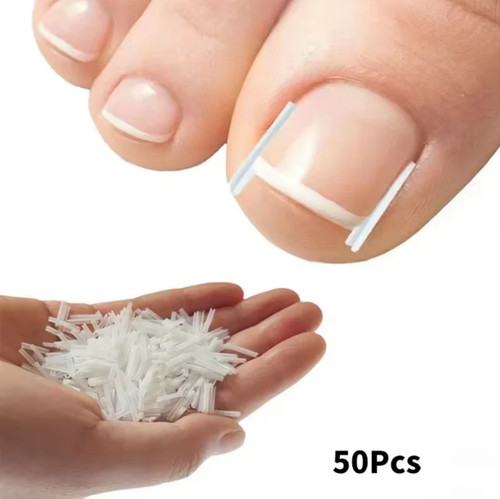 50pcs ingrown toenail - 50pcs,