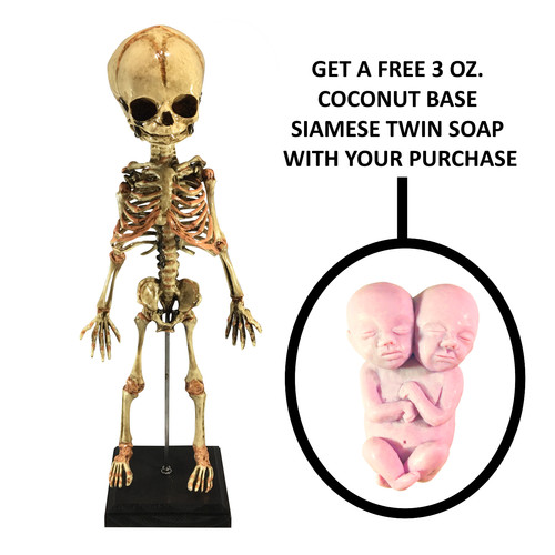 Aged fetus skeleton medical - aged,