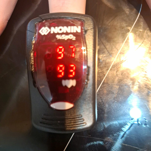 Nonin onyx model 9550 - onyx,