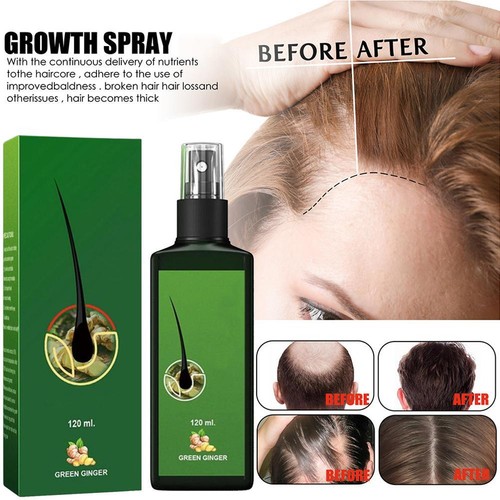 Hair lotion 30 120ml neo - lotion-30/120ml,