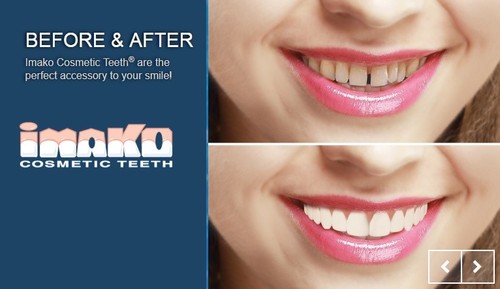New imako cosmetic teeth - new,