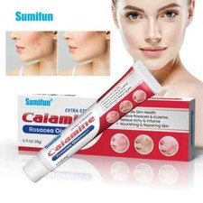 New rosacea ointment - rosacea,