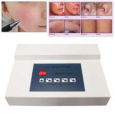 High Frequency Spider Veins