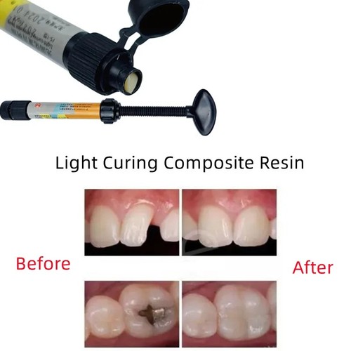 New dental cement cavity - dental,