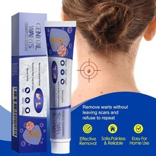 STRONG SKIN TAG REMOVER Cream NATURAL TREATMENT MOLES WARTS and TAGS