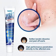 Warts Remover Ointment Wart Treatment Cream Skin Tag Remover Herbal 20g