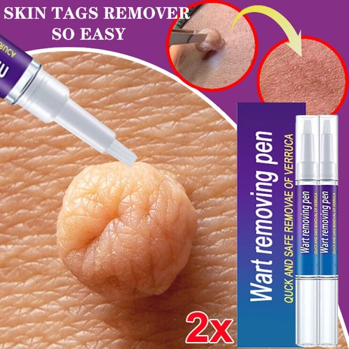 2pack 5ml wart - 5ml, remover