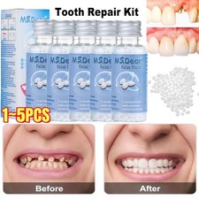Tooth Repair Granules
