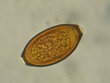 Sheep parasite worm egg samples. Tapeworm, Nematodirus, Coccida and Whipworm.