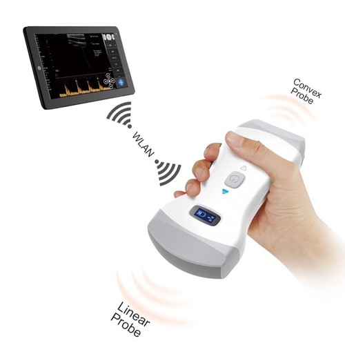 Wireless ultrasound scanner - ultrasound,