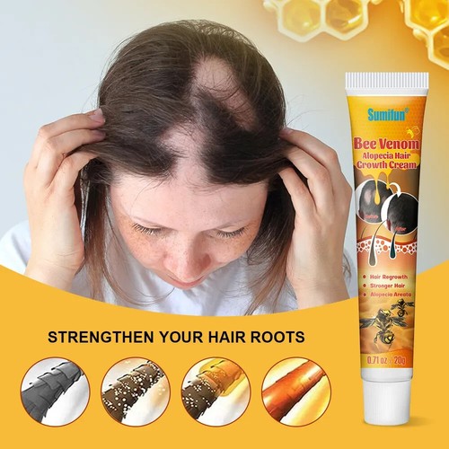 New 20g natural alopecia - natural,