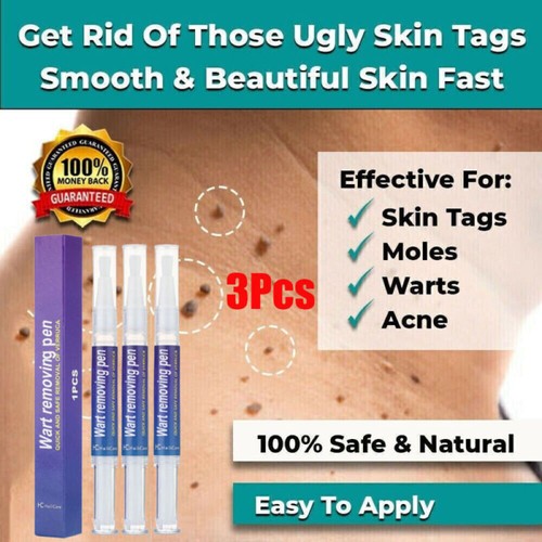 3pack hours wart - 3pack,