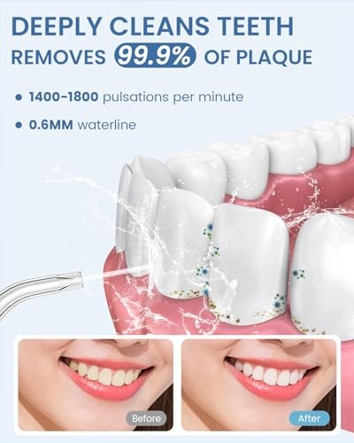 Auiei water flosser - auiei,