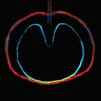 Xtc apple venus - venus:, wasp