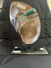Old Vintage Model Of Human Liver