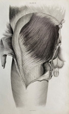 1824 Antique Print; Anatomical Illustration Upper Leg by W.H. Lizars