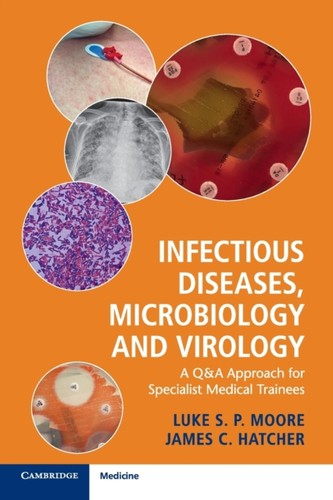 Infectious diseases - infectious,
