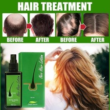 2026 Neo Hair Lotion 120Ml